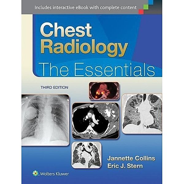 Chest Radiology, Collins