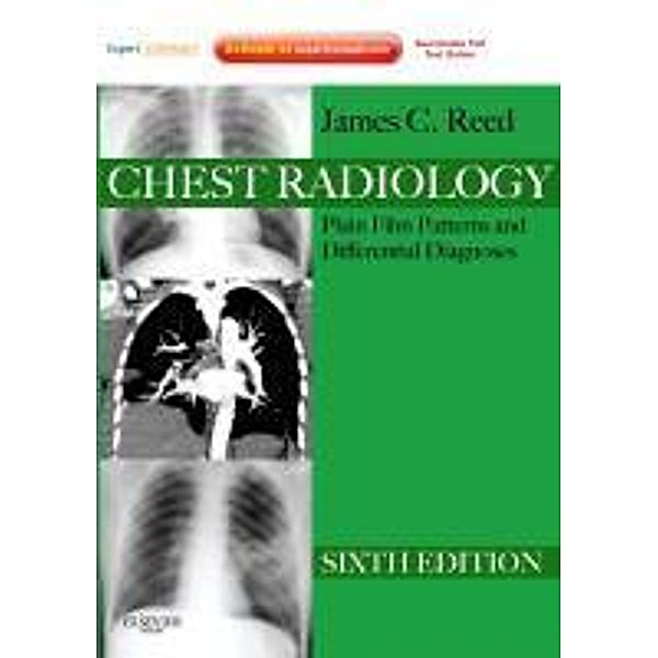 Chest Radiology, James C. Reed