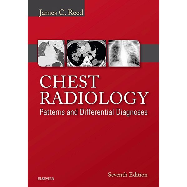 Chest Radiology: Patterns and Differential Diagnoses E-Book, James C. Reed