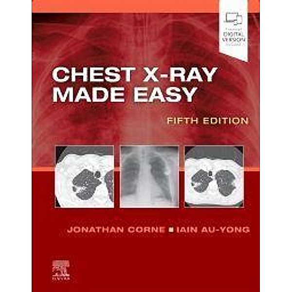 Chest X-Ray Made Easy, Jonathan Corne, Iain Au-Yong