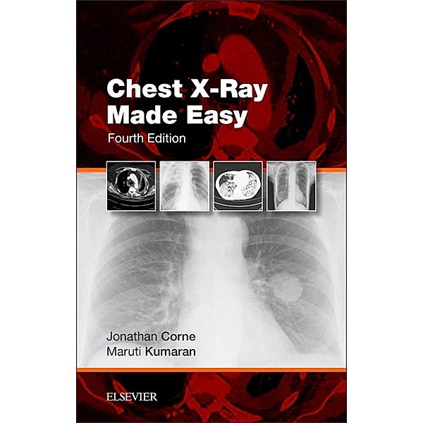 Chest X-Ray Made Easy E-Book, Jonathan Corne, Maruti Kumaran