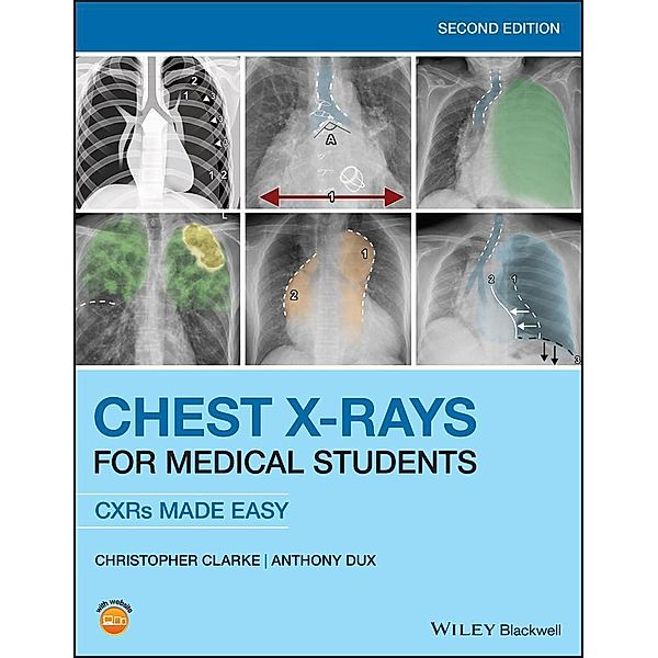 Chest X-Rays for Medical Students, Christopher Clarke, Anthony Dux
