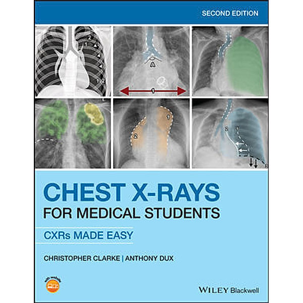 Chest X-Rays for Medical Students, Christopher Clarke, Anthony Dux