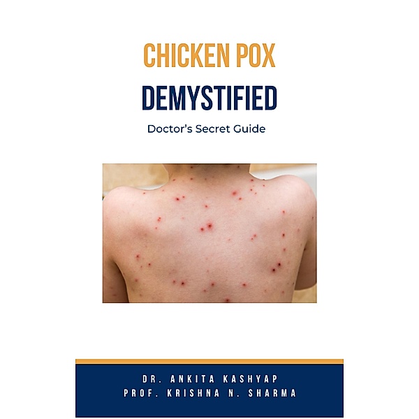 Chickenpox Demystified: Doctor's Secret Guide, Ankita Kashyap, Krishna N. Sharma