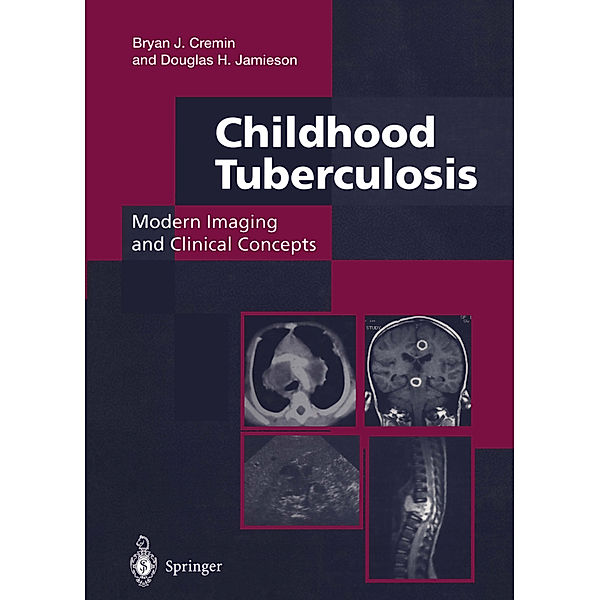 Childhood Tuberculosis: Modern Imaging and Clinical Concepts, Bryan J. Cremin, Douglas H. Jamieson