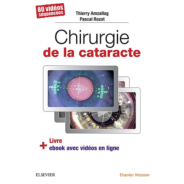 Chirurgie de la cataracte, Pascal Rozot, Thierry Amzallag