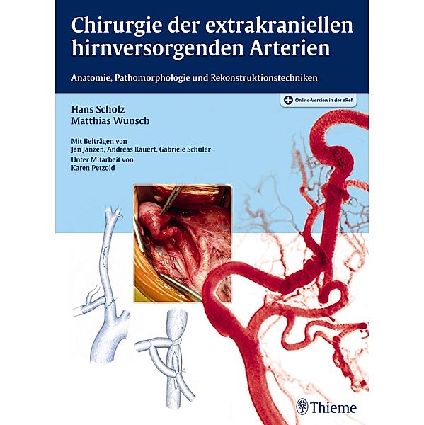 Chirurgie der extrakraniellen hirnversorgenden Arterien, Hans Scholz, Matthias Wunsch