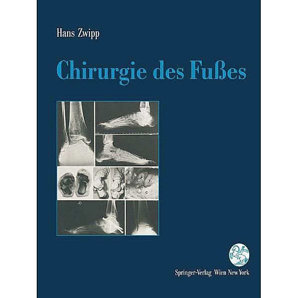 Chirurgie des Fußes, Hans Zwipp