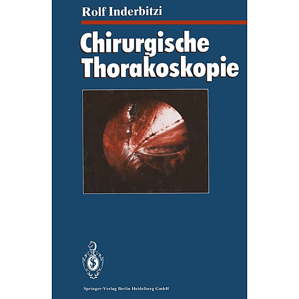 Chirurgische Thorakoskopie, Rolf Gilbert Carl Inderbitzi
