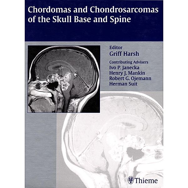 Chordomas and Chondrosarcomas of the Skull Base and Spine