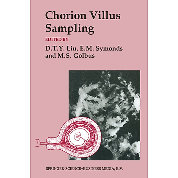 Chorion Villus Sampling, Mitchell S. Golbus, D. T. Y. Liu, E. M. Symonds