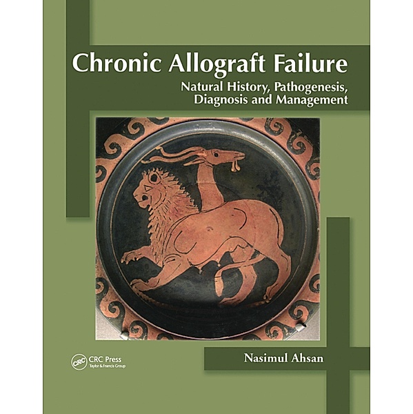 Chronic Allograft Failure, Nasimul Ahsan