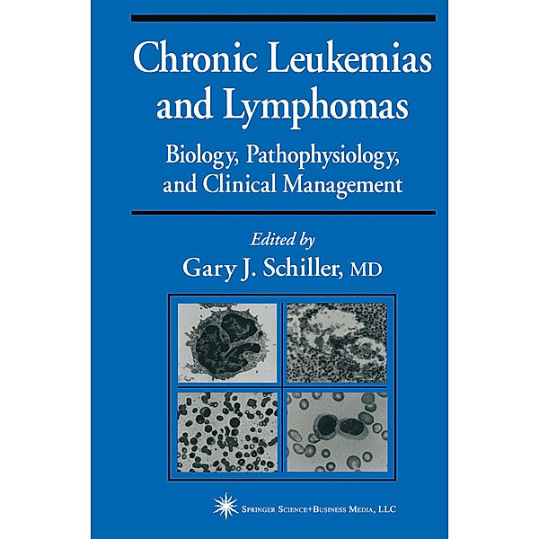 Chronic Leukemias and Lymphomas