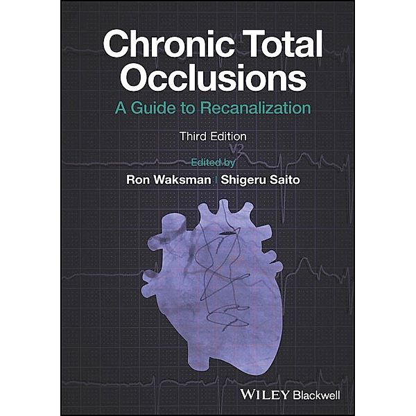 Chronic Total Occlusions