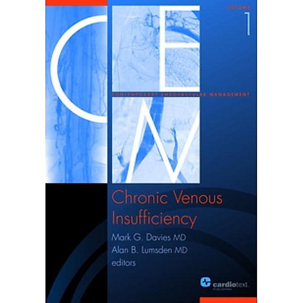 Chronic Venous Insufficiency / Contemporary Endovascular Management