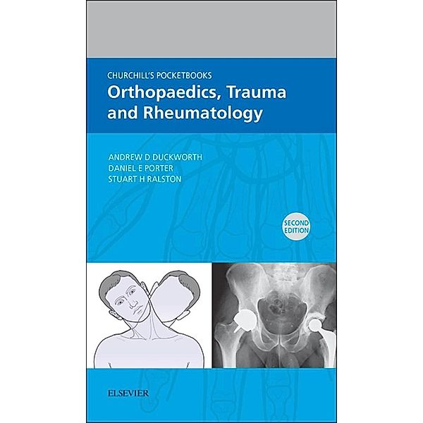 Churchill's Pocketbook of Orthopaedics, Trauma and Rheumatology - E-Book, Andrew D. Duckworth, Daniel Porter, Stuart H. Ralston