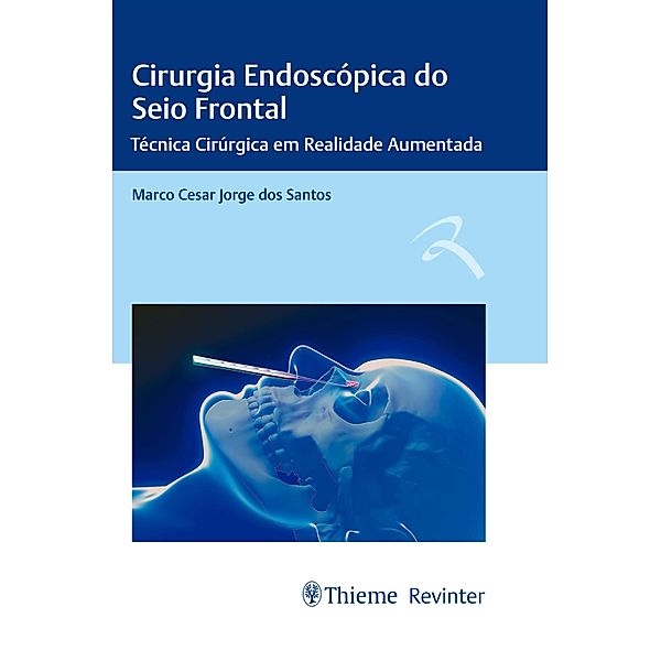 Cirurgia Endoscópica do Seio Frontal, Marco Cesar Jorge dos Santos