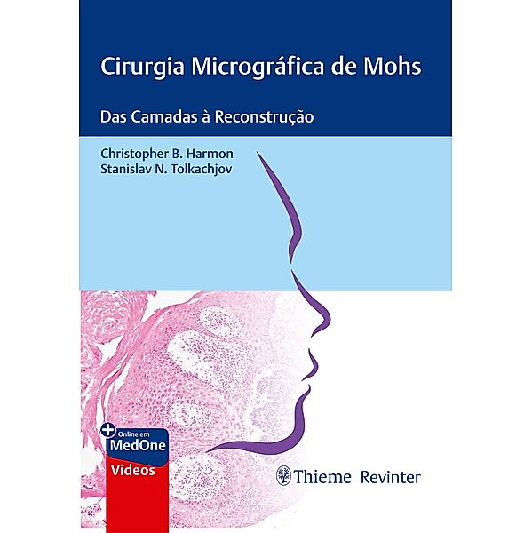 Cirurgia Micrográfica de Mohs, Christopher B. Harmon, Stanislav N. Tolkachjov