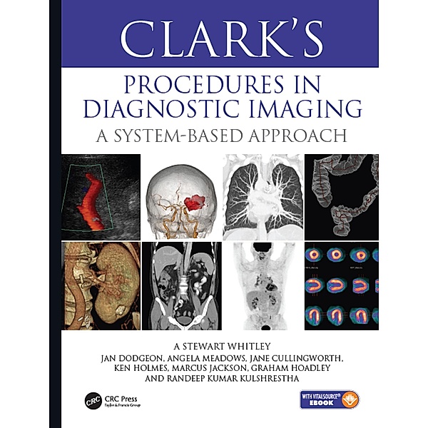 Clark's Procedures in Diagnostic Imaging, A Stewart Whitley, Jan Dodgeon, Angela Meadows, Jane Cullingworth, Ken Holmes, Marcus Jackson, Graham Hoadley, Randeep Kulshrestha