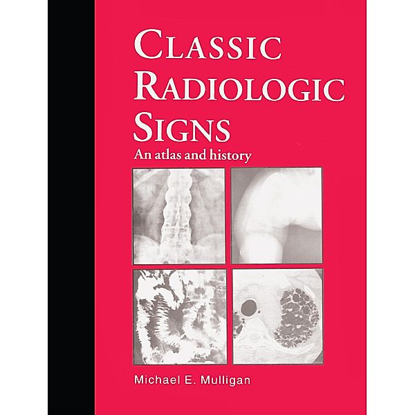 Classic Radiologic Signs, M. E. Mulligan