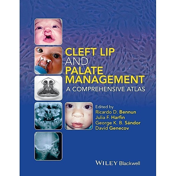 Cleft Lip and Palate Management, George K. B. Sándor, David Genecov