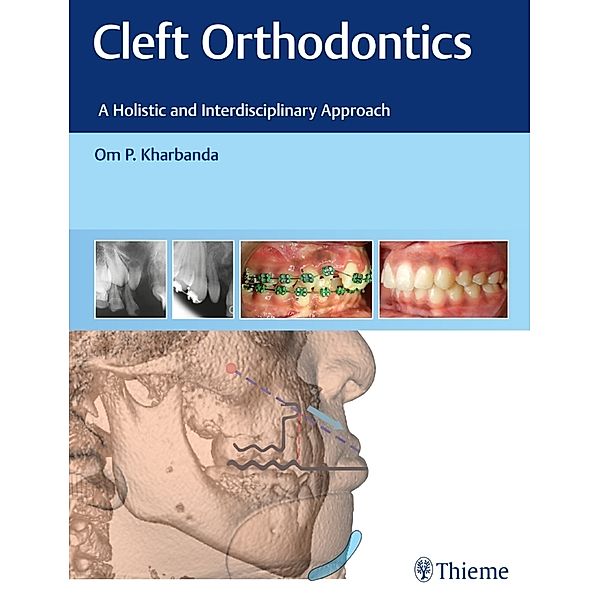 Cleft Orthodontics, Om P. Kharbanda