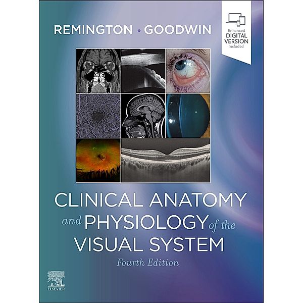 Clinical Anatomy and Physiology of the Visual System E-Book, Lee Ann Remington, Denise Goodwin