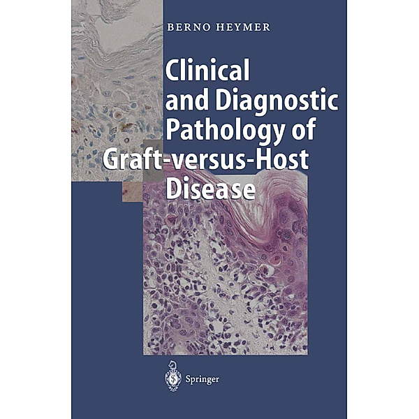 Clinical and Diagnostic Pathology of Graft-versus-Host Disease, Berno Heymer