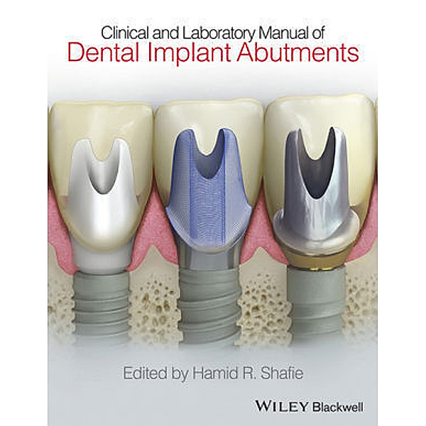 Clinical and Laboratory Manual of Dental Implant Abutments, Hamid R. Shafie