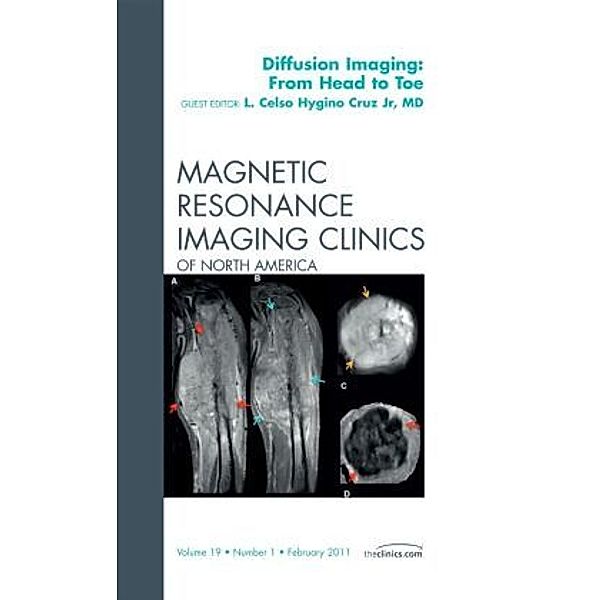 Clinical Applications of Diffusion Imaging: from Head to Toe, An Issue of Magnetic Resonance Imaging Clinics, Celso Hygino