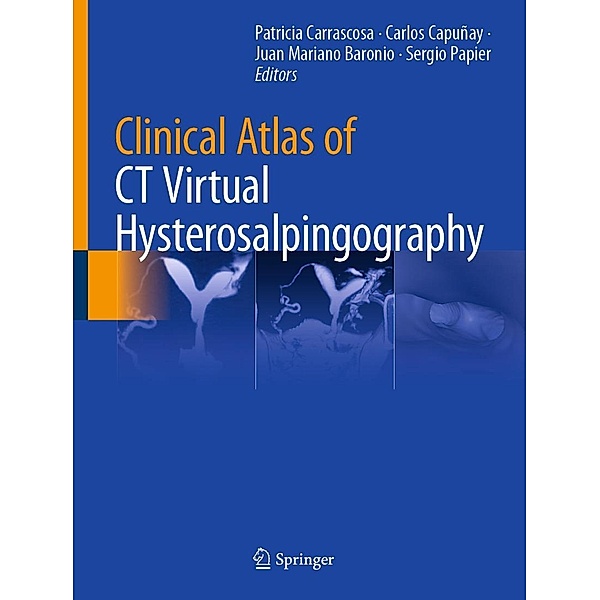 Clinical Atlas of CT Virtual Hysterosalpingography