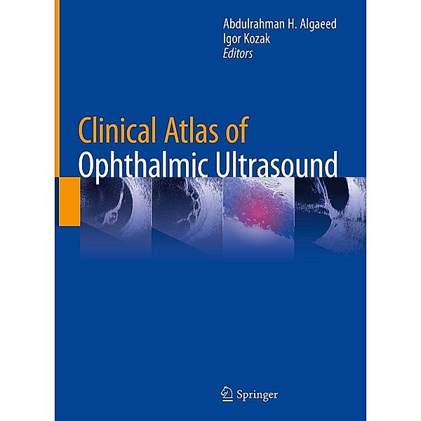 Clinical Atlas of Ophthalmic Ultrasound