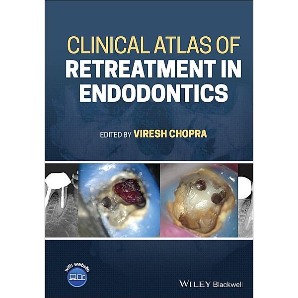 Clinical Atlas of Retreatment in Endodontics, Viresh Chopra