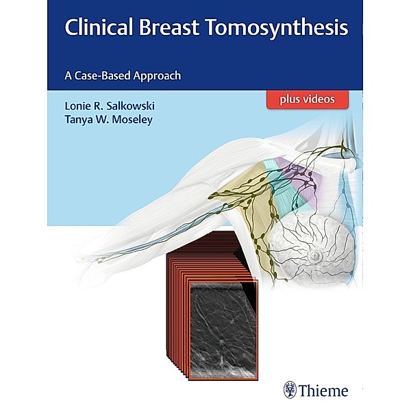 Clinical Breast Tomosynthesis, Lonie R. Salkowski, Tanya Moseley