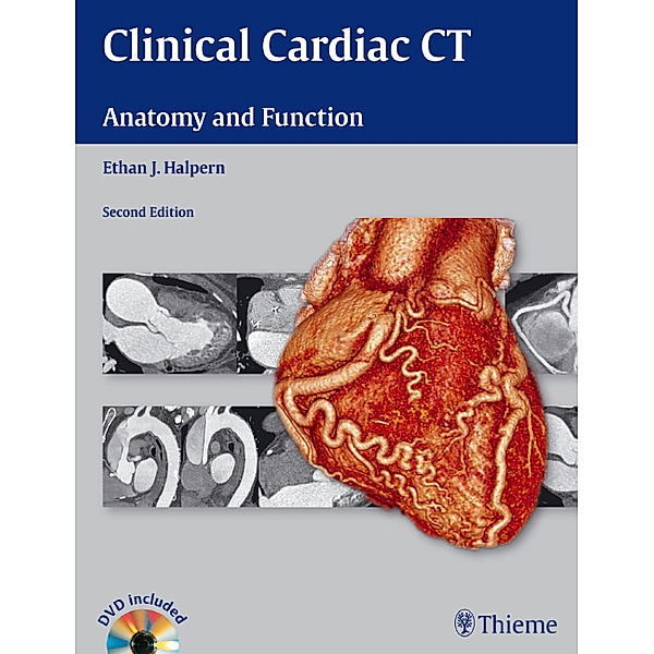 Clinical Cardiac CT, Ethan J. Halpern