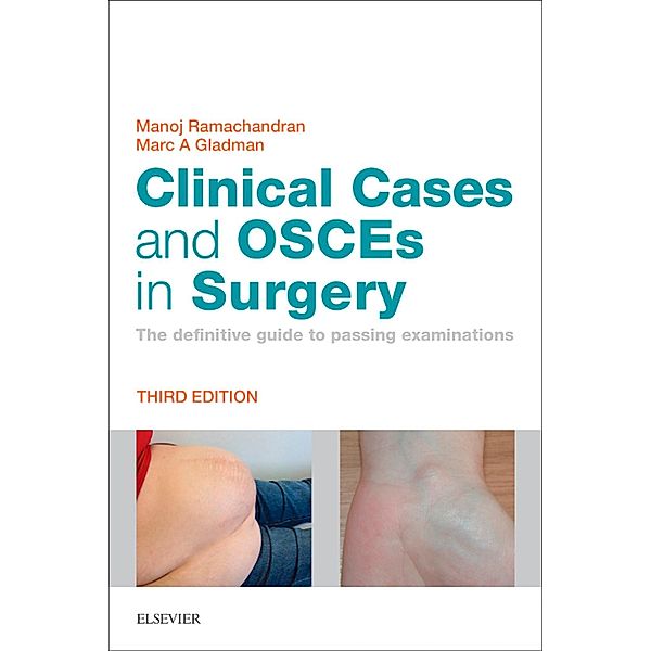 Clinical Cases and OSCEs in Surgery E-Book, Manoj Ramachandran, Marc A Gladman