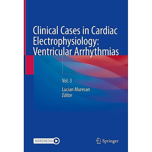 Clinical Cases in Cardiac Electrophysiology: Ventricular Arrhythmias