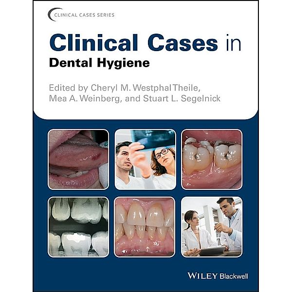 Clinical Cases in Dental Hygiene / Clinical Cases