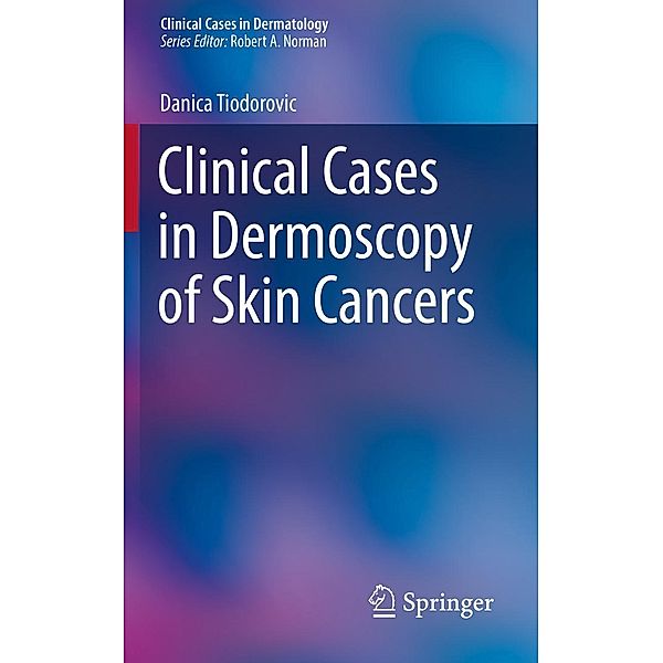 Clinical Cases in Dermoscopy of Skin Cancers / Clinical Cases in Dermatology, Danica Tiodorovic