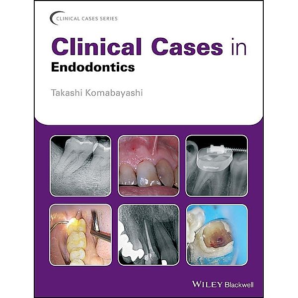 Clinical Cases in Endodontics / Clinical Cases, Takashi Komabayashi