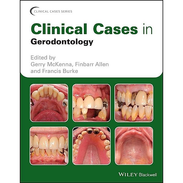 Clinical Cases in Gerodontology / Clinical Cases, Gerry McKenna, Finbarr Allen, Francis Burke