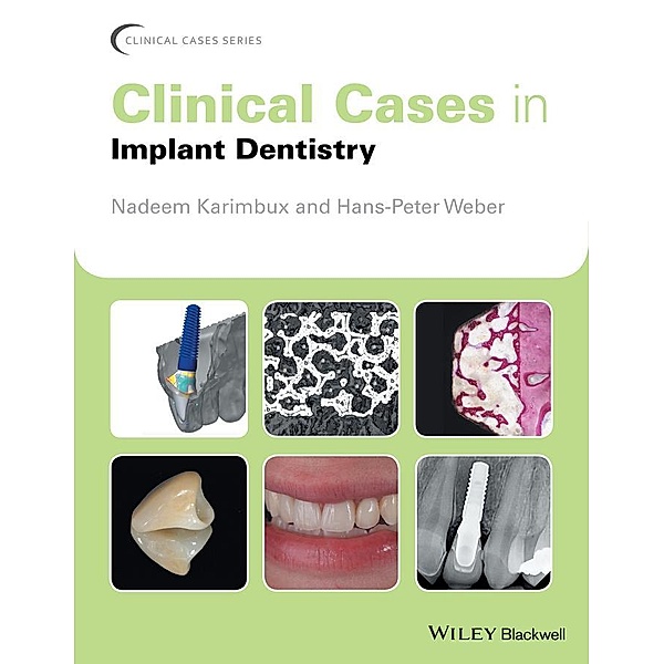 Clinical Cases in Implant Dentistry / Clinical Cases
