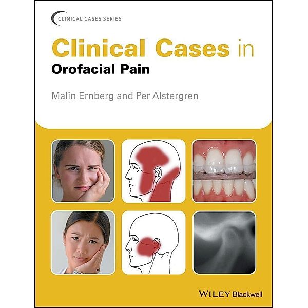 Clinical Cases in Orofacial Pain / Clinical Cases, Malin Ernberg, Per Alstergren