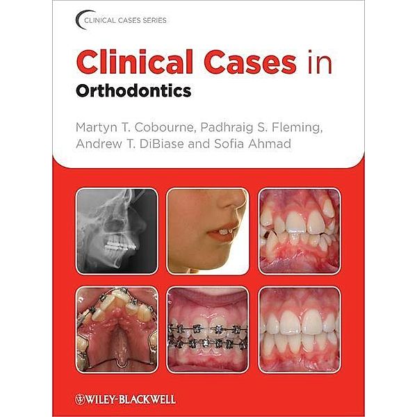 Clinical Cases in Orthodontics / Clinical Cases, Martyn T. Cobourne, Padhraig S. Fleming, Andrew T. DiBiase, Sofia Ahmad