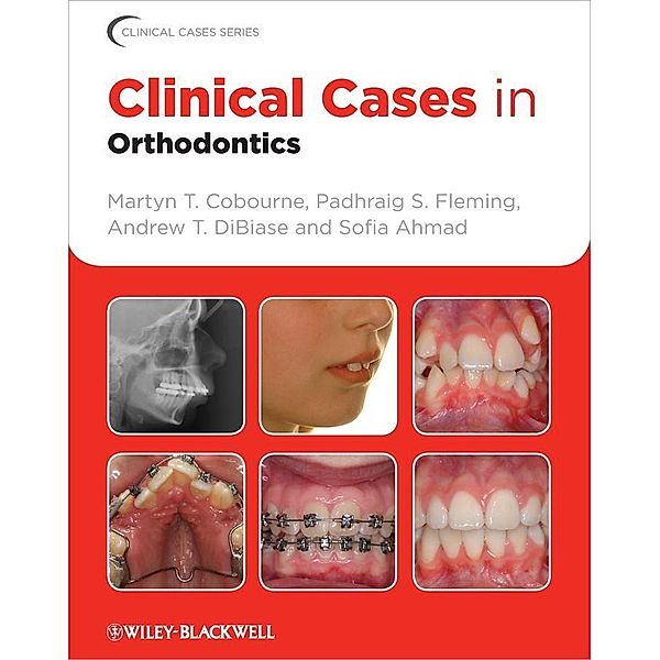Clinical Cases in Orthodontics / Clinical Cases, Martyn T. Cobourne, Padhraig S. Fleming, Andrew T. DiBiase, Sofia Ahmad