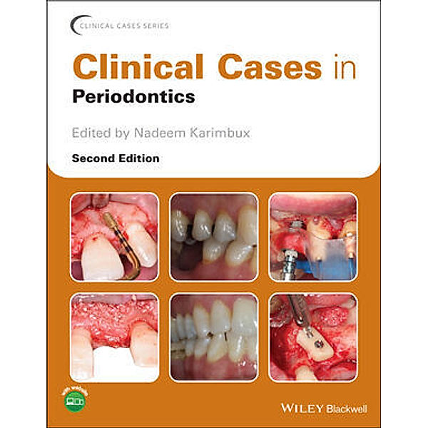 Clinical Cases in Periodontics