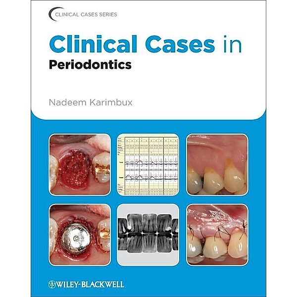 Clinical Cases in Periodontics / Clinical Cases