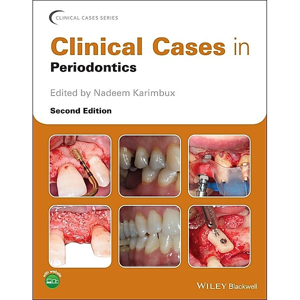 Clinical Cases in Periodontics / Clinical Cases