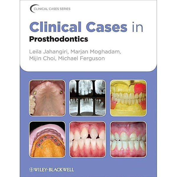 Clinical Cases in Prosthodontics / Clinical Cases, Leila Jahangiri, Marjan Moghadam, Mijin Choi, Michael Ferguson