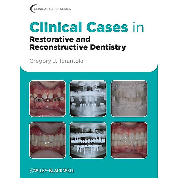 Clinical Cases in Restorative and Reconstructive Dentistry / Clinical Cases, Gregory J. Tarantola